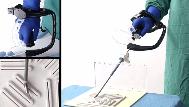 A Revolução da Cirurgia a Preço Acessível! Um Davi para Da&nbsp;Vinci!